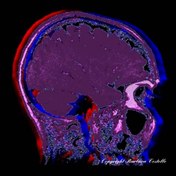 Soulmate 1 Limited Edition Art Gallery Image